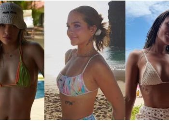 celulite-teen:-como-lidar-com-os-furinhos-na-pele-antes-dos-18-–-jornal-a-voz-de-campos
