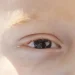 Baixa visão na infância: especialista alerta para diagnóstico precoce