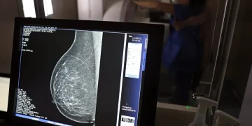 Médicos lançam guia para evitar recusa de mamografia digital