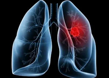Saiba o que é adenocarcinoma pulmonar, câncer que atinge o Papa Leão