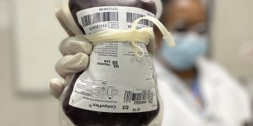 Saúde aprova protocolo para tratar crianças com hemofilia A